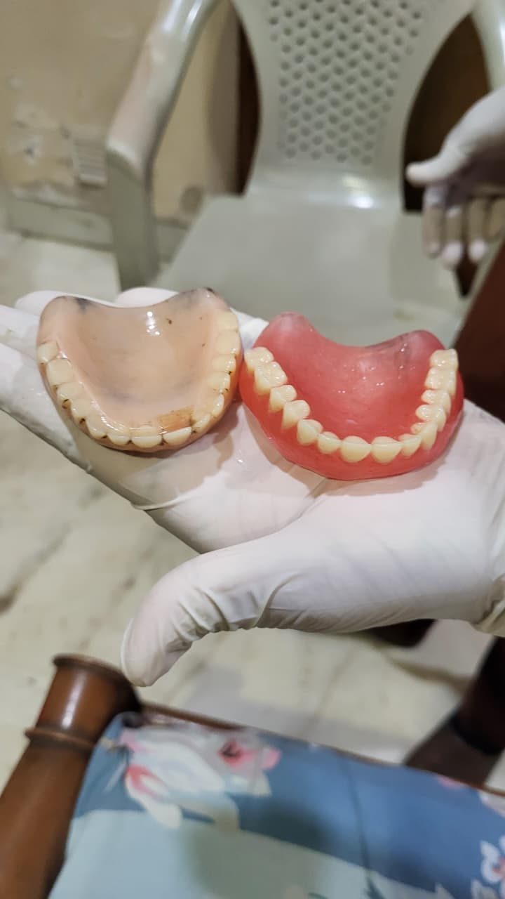 A set of dentures prepared for an at-home fitting for a senior patient