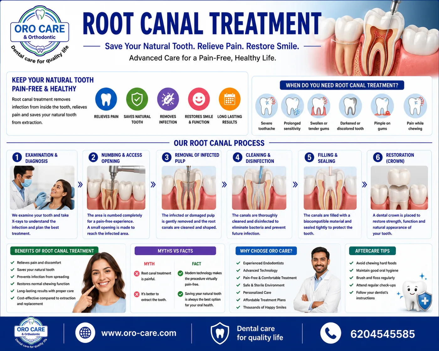 Oro Care & Orthodontic Centre root canal treatment infographic showing the examination, numbing, pulp removal, cleaning, filling and crown restoration process