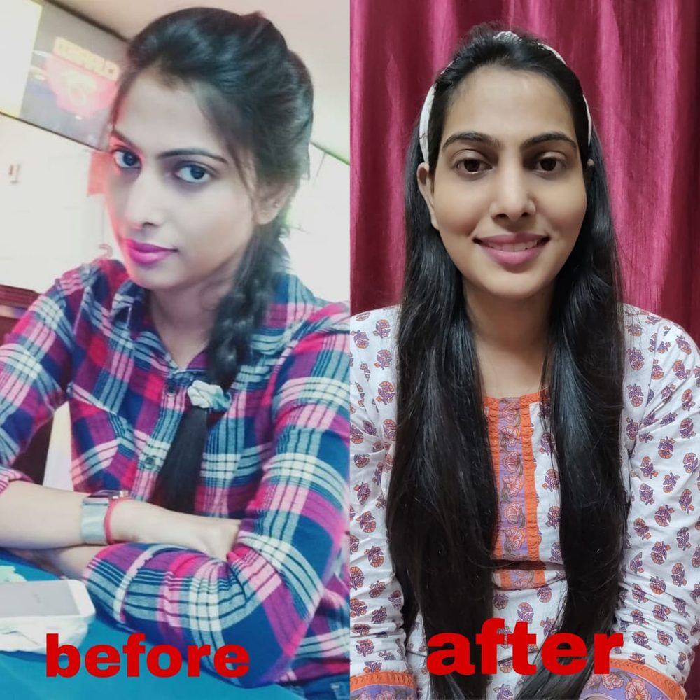 Real patient before and after photo shared after their treatment at Oro Care