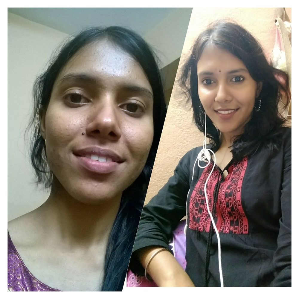 Real patient before and after photo shared after their treatment at Oro Care