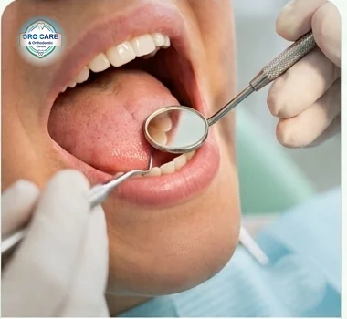 Dentist using a mouth mirror to visually examine a patient's mouth during oral cancer screening
